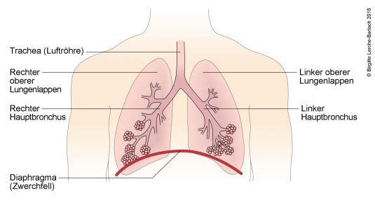 Bronchialbaum