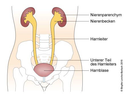 Urinreflux Grad 3