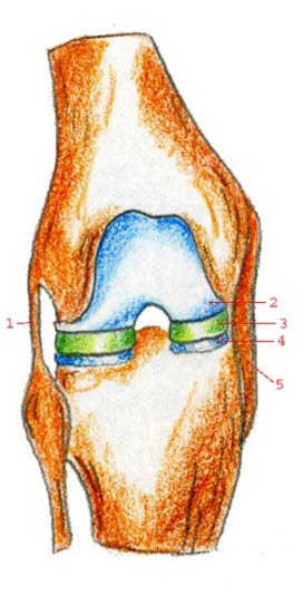 Frontalansicht auf das rechte Kniegelenk: 1= laterales Kollateralband, 2 = Knorpel, 3 = Meniskus, 4 = Knorpel, 5 = mediales Kollateralband