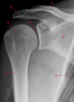 Normale Frontalaufnamen der rechten Schulter. 1. Humerus, 2. Caput humeri, 3. Acromion, 4. Gelenkspalt, 5. Clavicula, 6. Costa, 7. Scapula