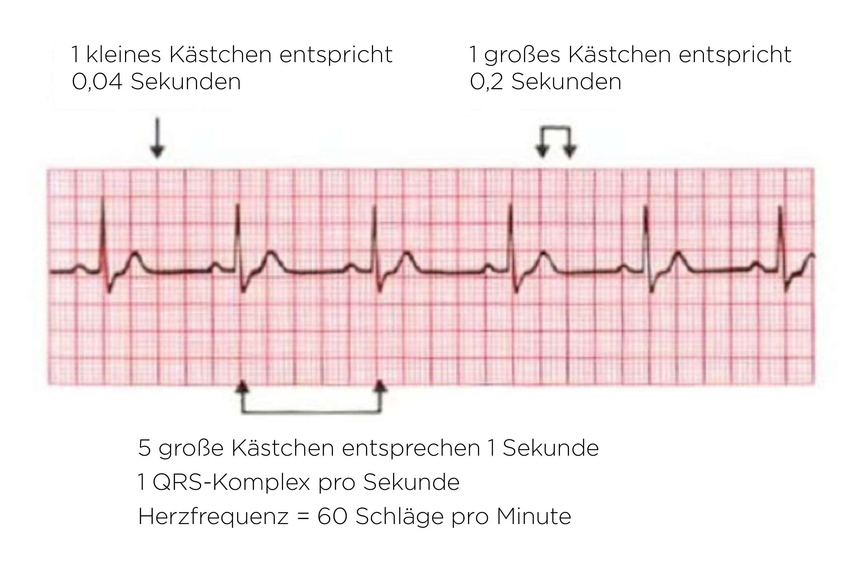 EKG-Auswertung