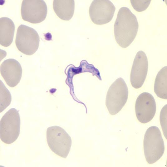 Blutausstrich (dünner Tropfen) mit Giemsa-Färbung, in dem die Trypanosomen zu sehen sind. Foto mit freundlicher Genehmigung von CDC (PHIL).