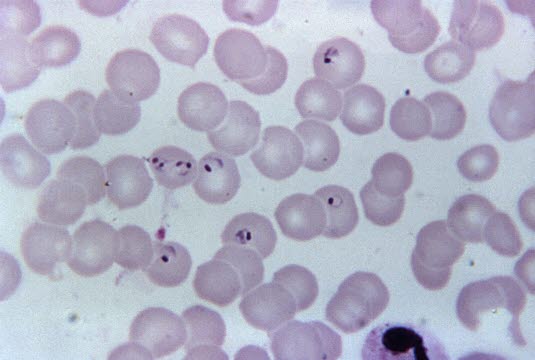 Plasmodium falciparum