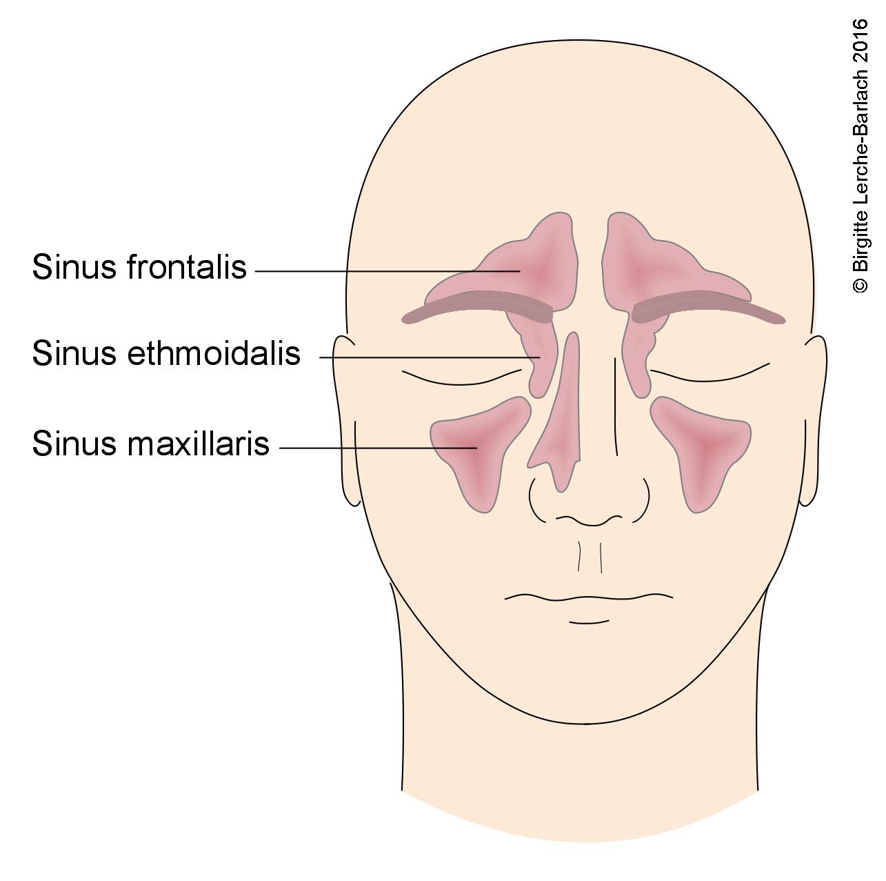 Nebenhöhlen, Sinus maxillaris/frontalis