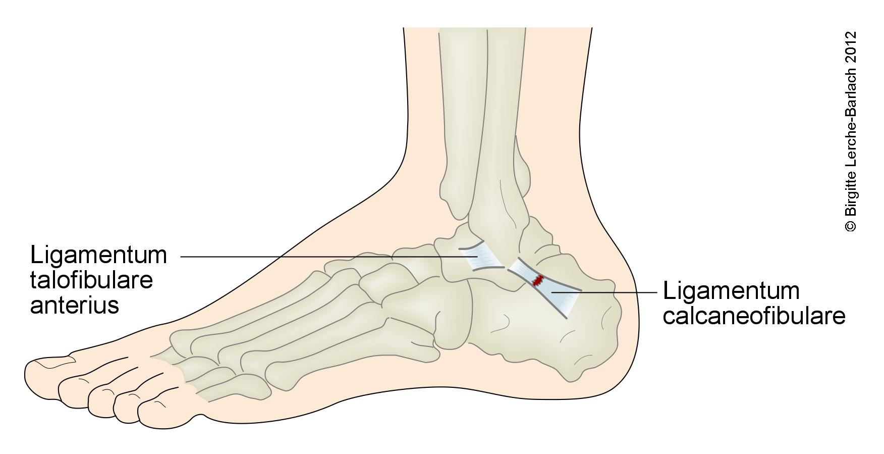 Sprunggelenksbaender lateral