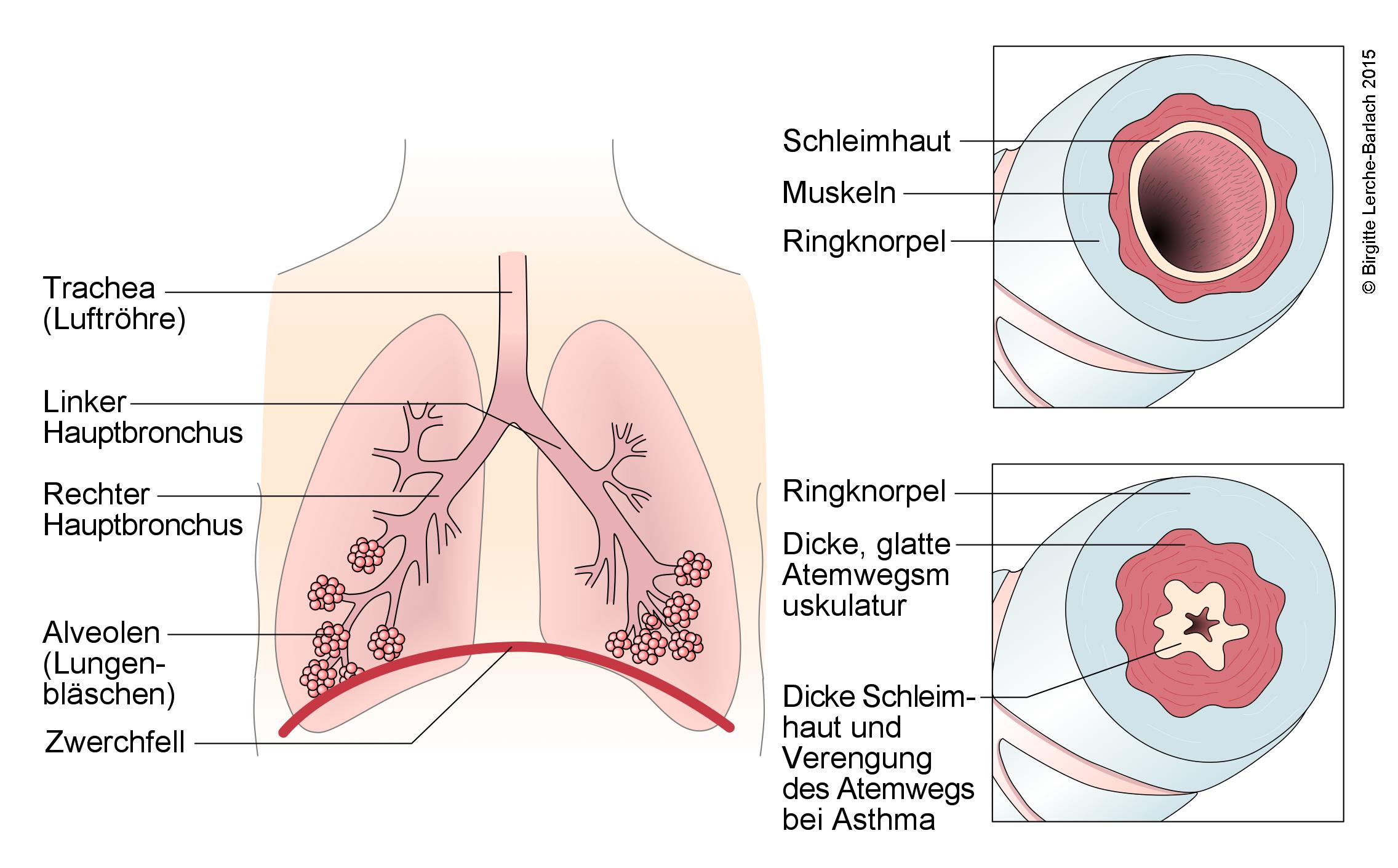 Atemwege und Veränderungen bei Asthma