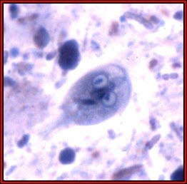 Giardia lamblia