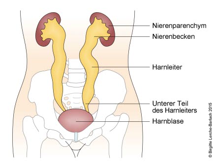 Urinreflux Grad 4