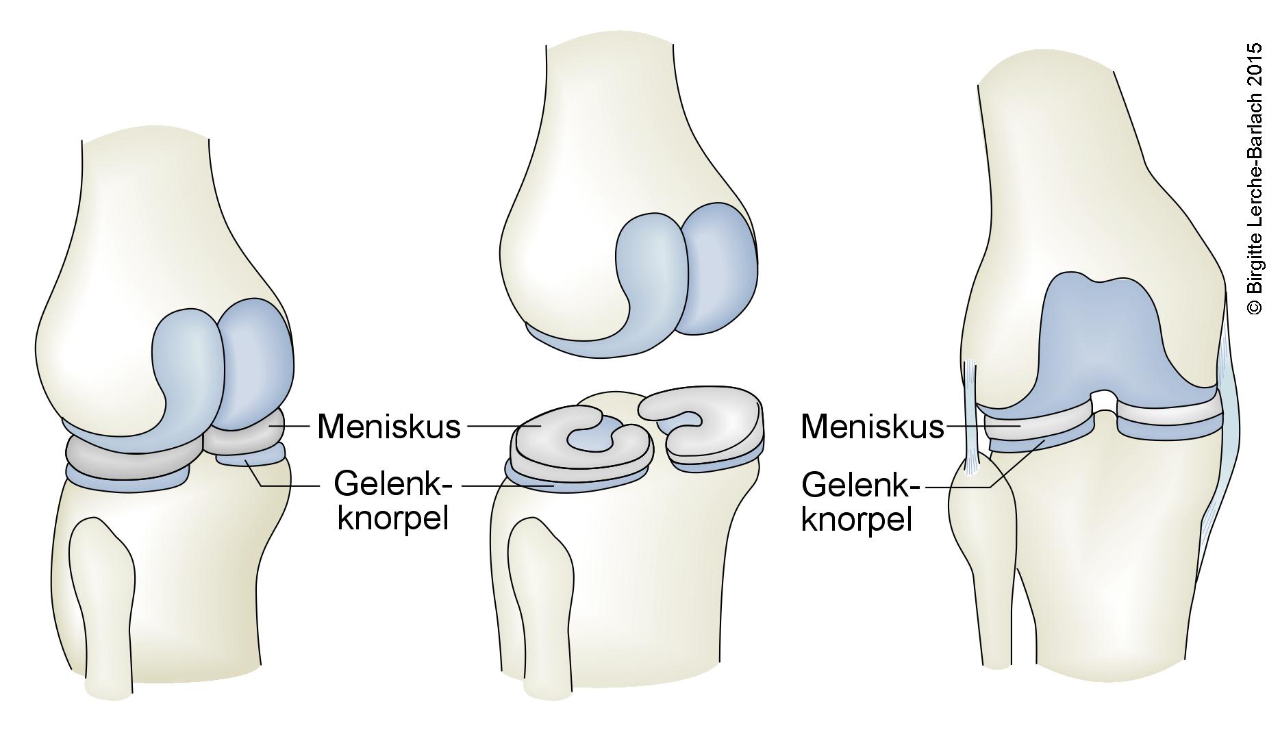 Menisken, Übersicht