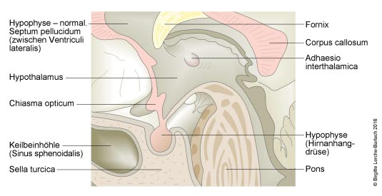 Hypophyse, Normalzustand (Farbe)