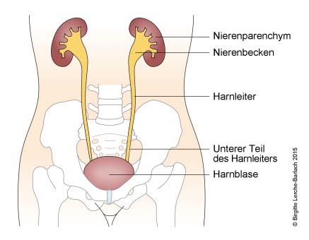 Urinreflux Grad 2