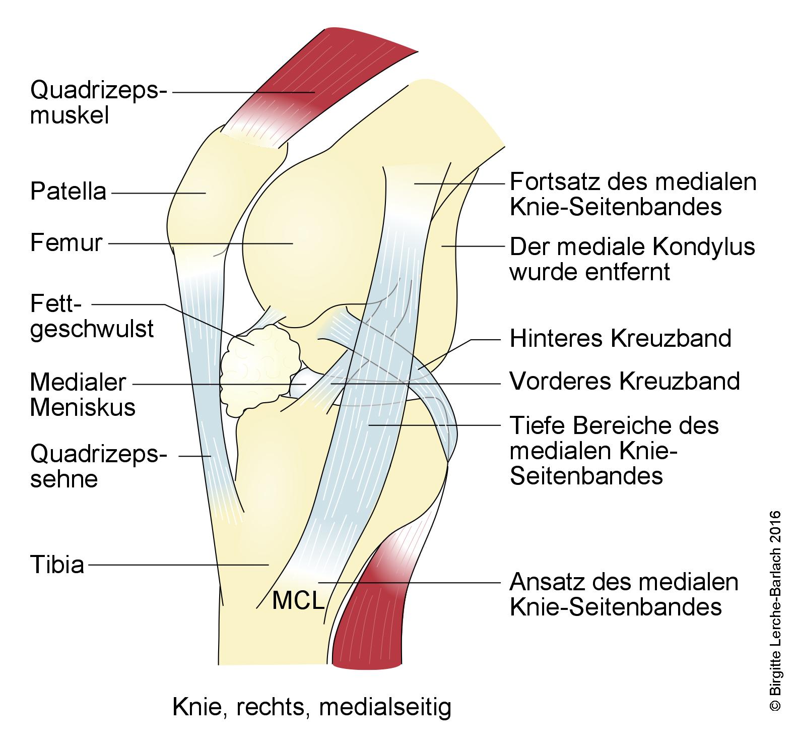 Knie, rechts, medialseitig.jpg