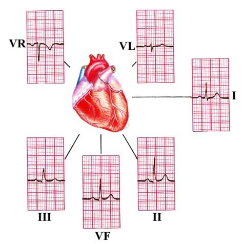 EKG in der vertikalen Ebene