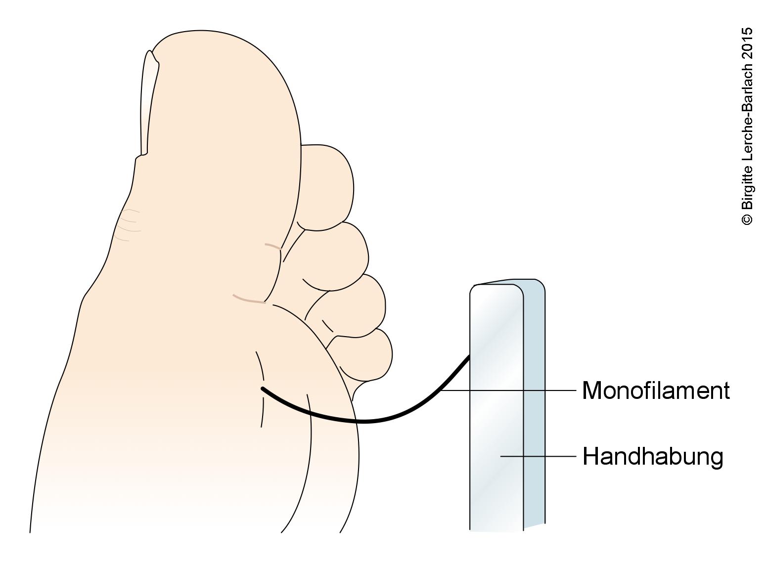 Monofilament, Sensibilitätsprüfung