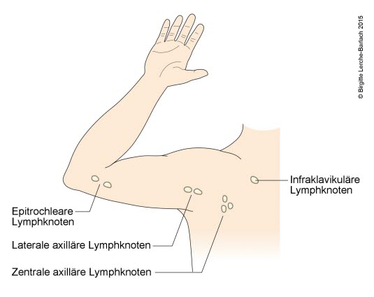 Lymphknoten in der Achselhöhle