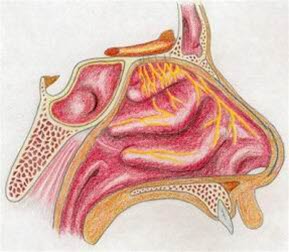 Allergische Rhinitis Bild 1