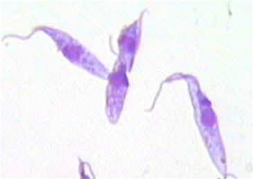 Trypanosoma cruzi. Schätzungsweise werden jedes Jahr 6–7 Millionen Menschen mit diesem Parasiten infiziert.