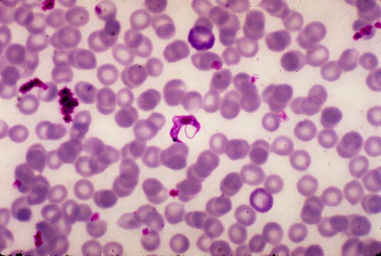 Giemsa-Färbung eines Blutausstrichs mit Trypanosoma cruzi. Foto mit freundlicher Genehmigung von CDC (PHIL).